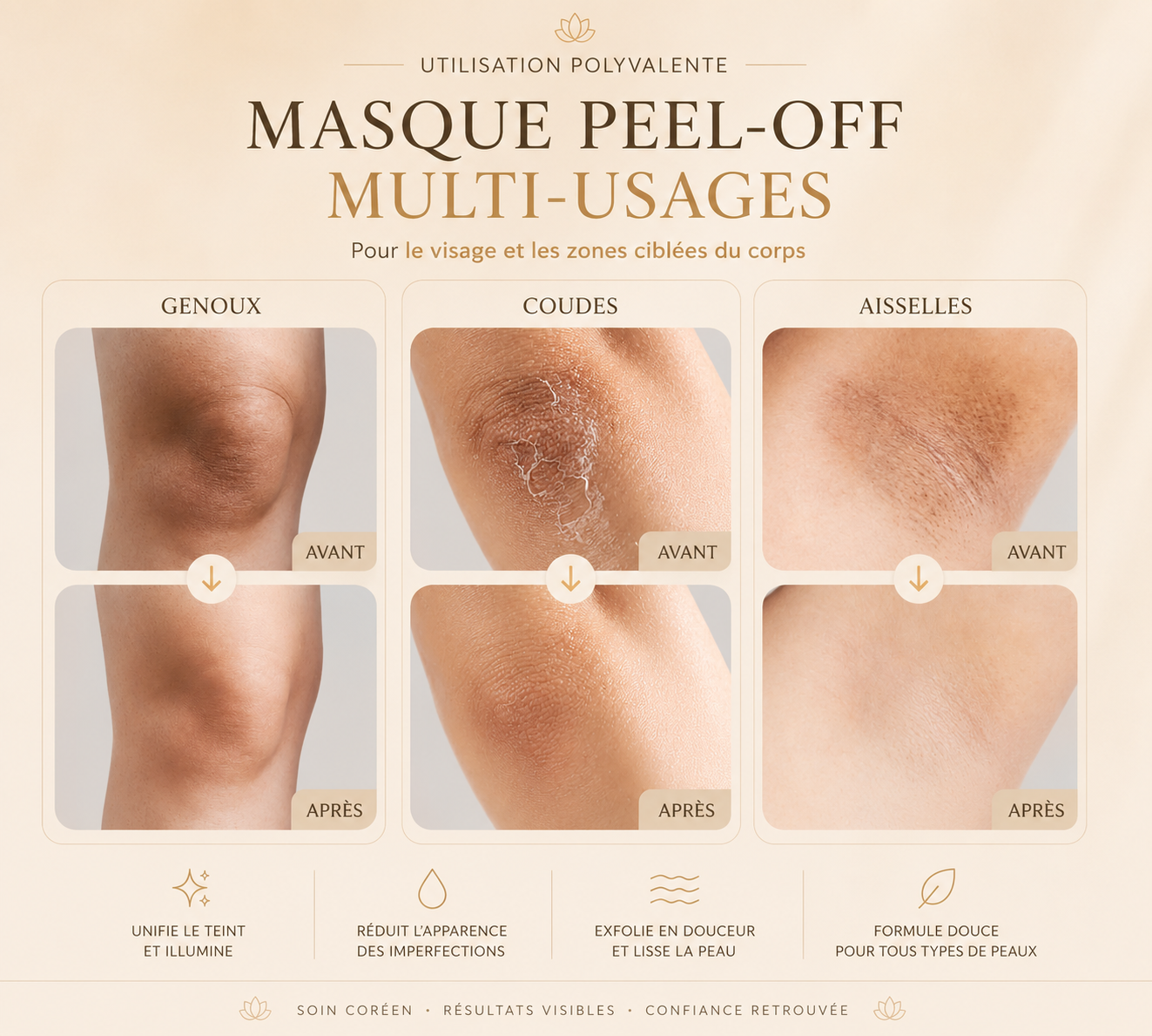 Hanora Lumi Peel Mask (anti-imperfections)