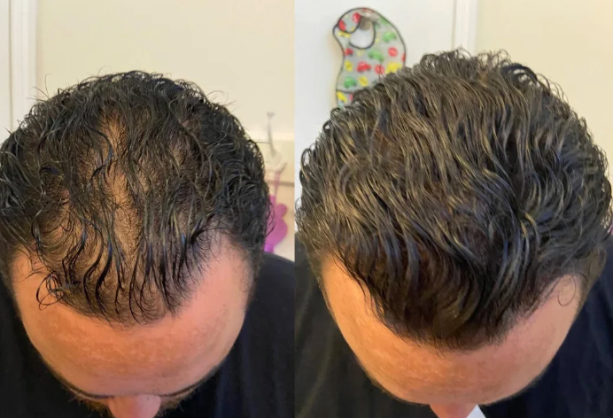 Correcteur Capillaire Waterproof — Densité Visible Instantanée
