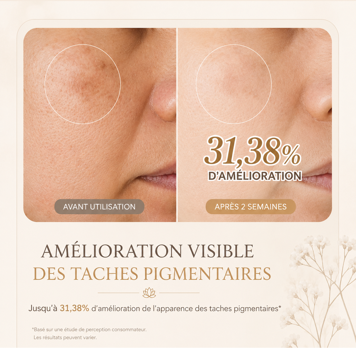 Hanora Lumi Peel Mask (anti-imperfections)