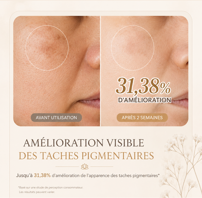 Hanora Lumi Peel Mask (anti-imperfections)